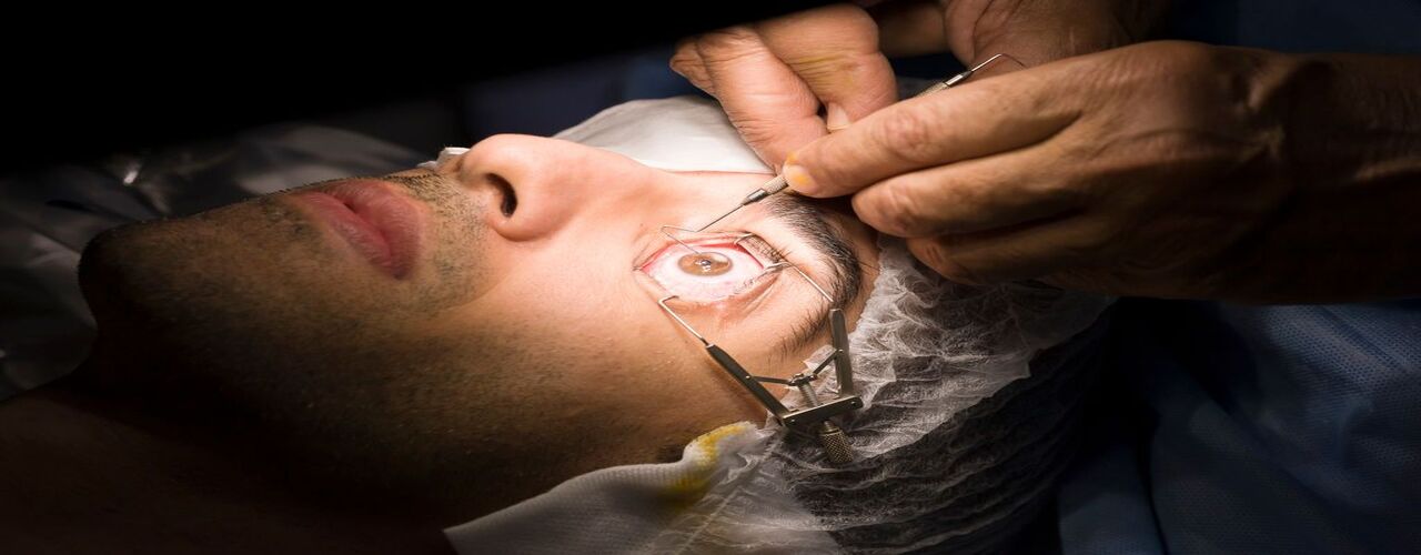 LASIK Laser Eye Surgery 